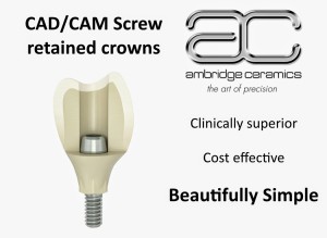 CAD Screw vs. Traditional Pricing Astra.010
