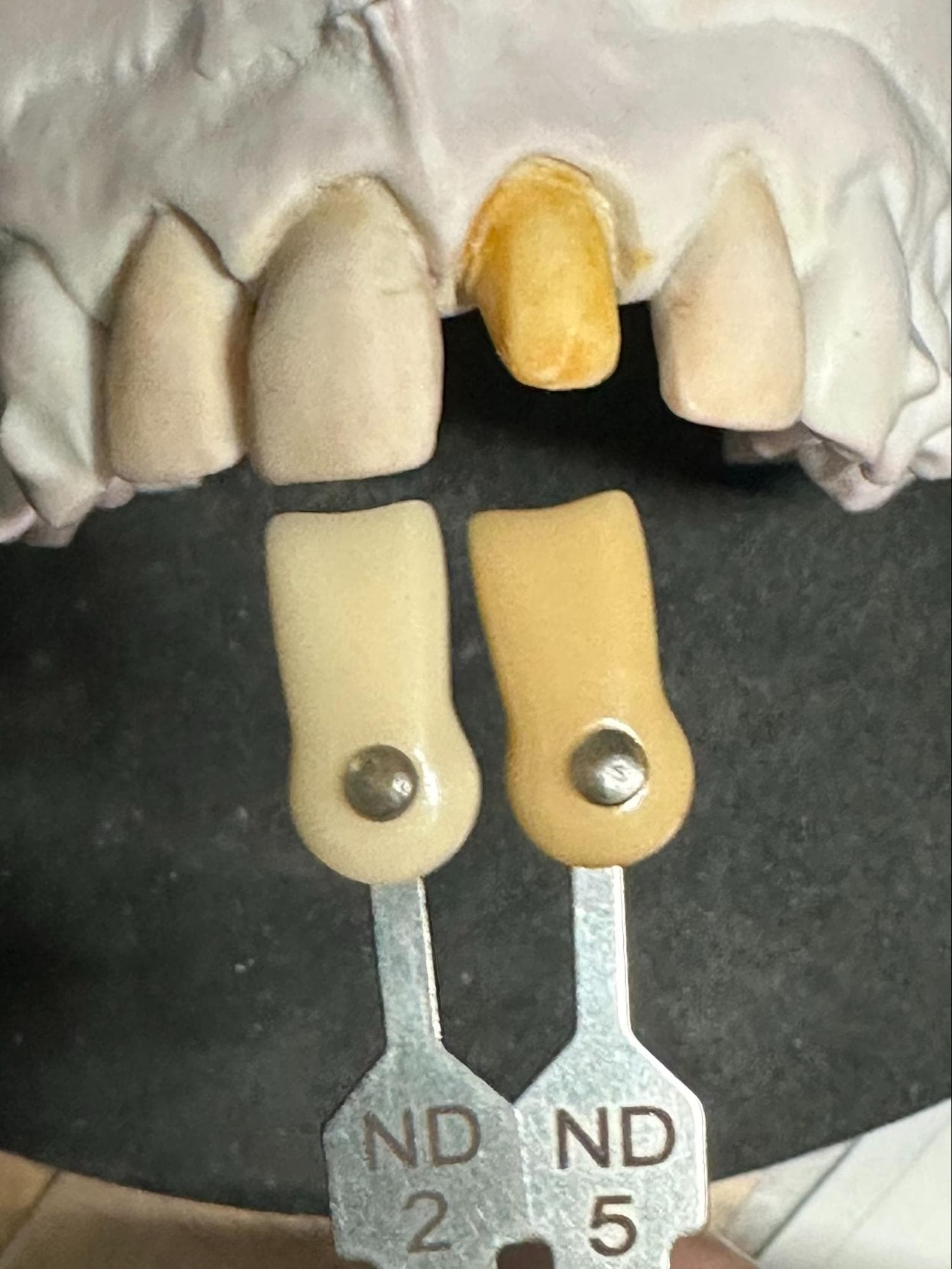 Images: Translucent crown against shade guide, ND shade guide conveying natural prep shade, and final crowns on coloured model