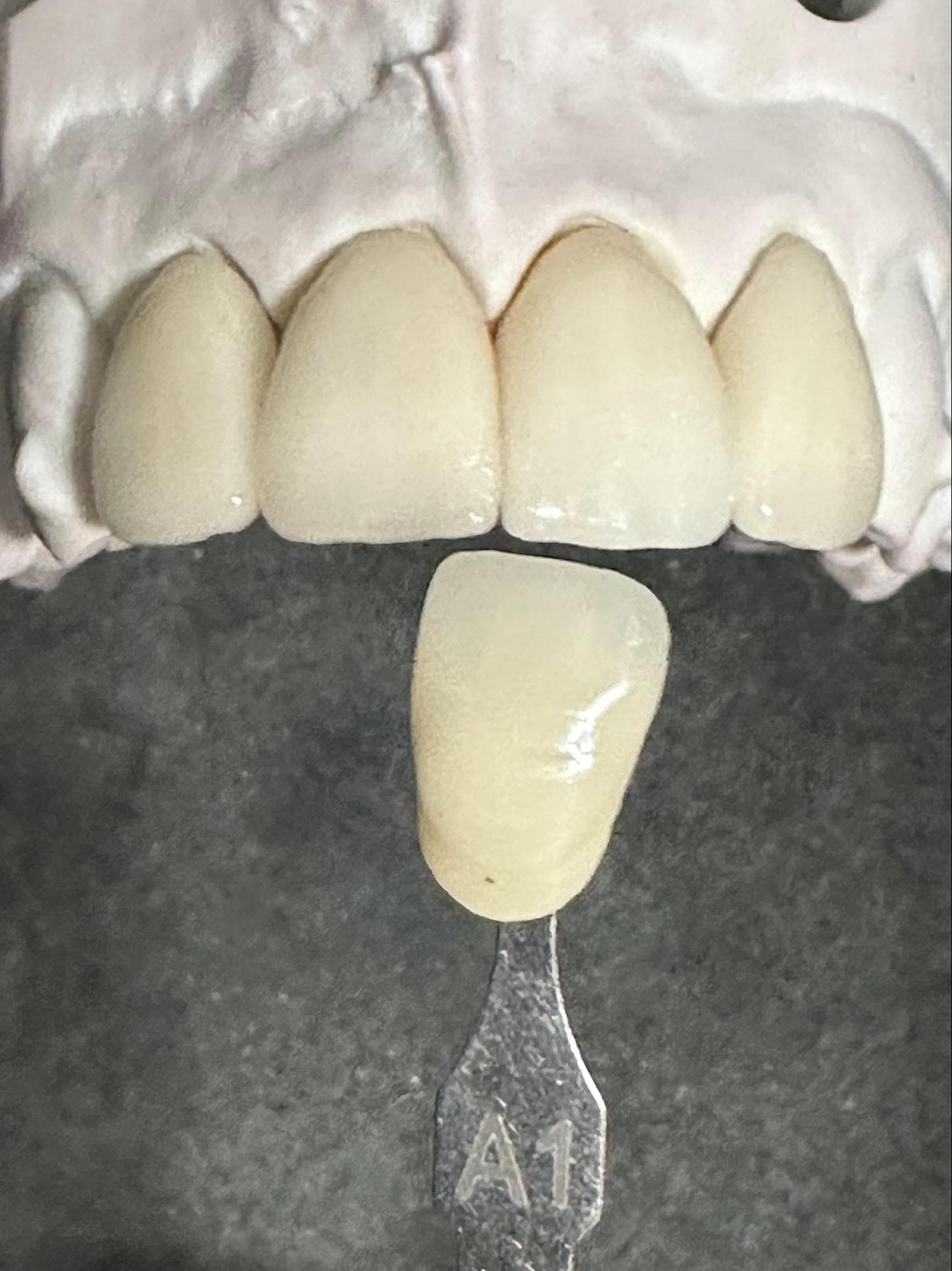 Images: Translucent crown against shade guide, ND shade guide conveying natural prep shade, and final crowns on coloured model