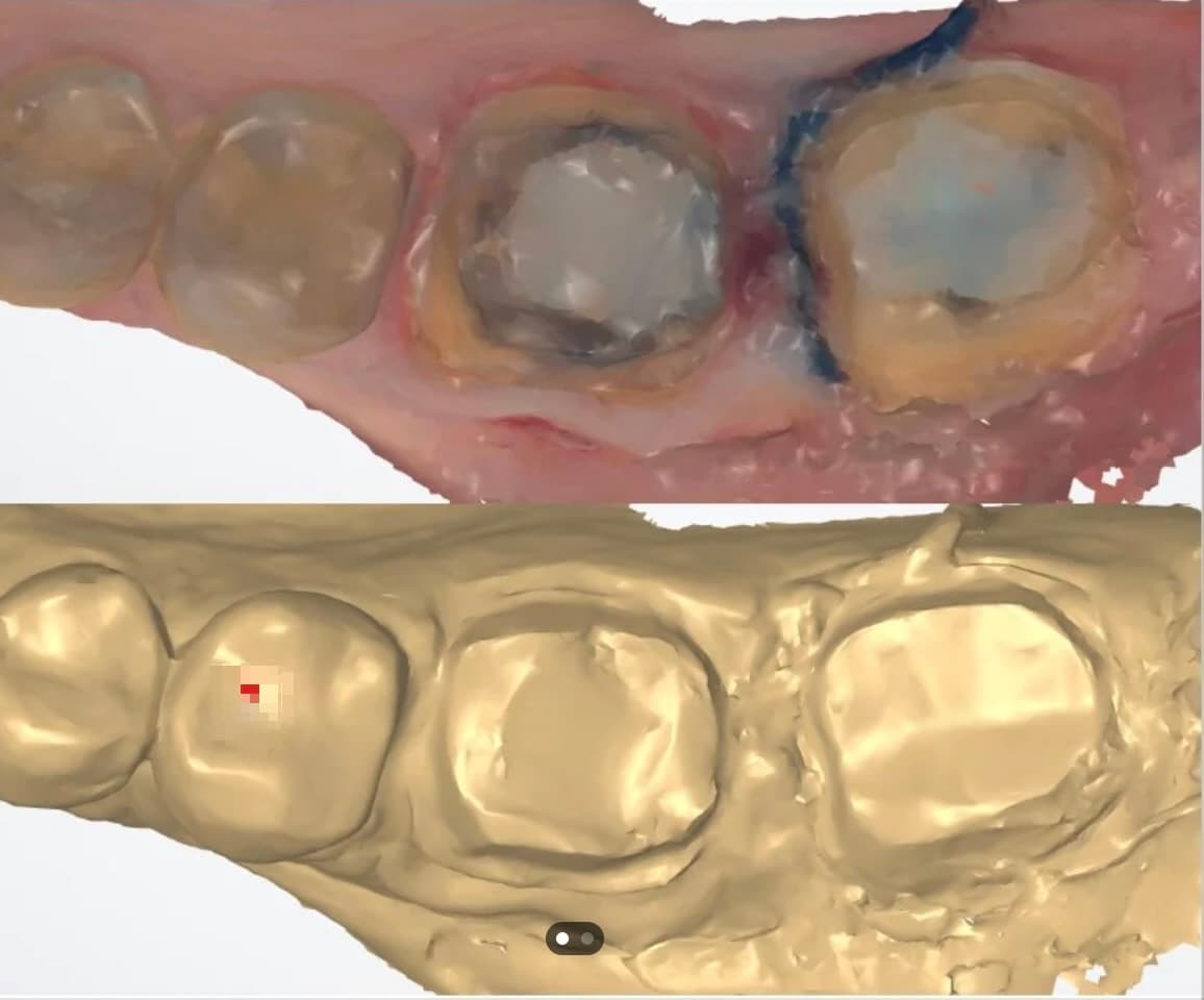 Colour scan vs Greyscale (Lab view) — notice the loss of margin contrast. A coloured scan fools the eyes into seeing the margin.