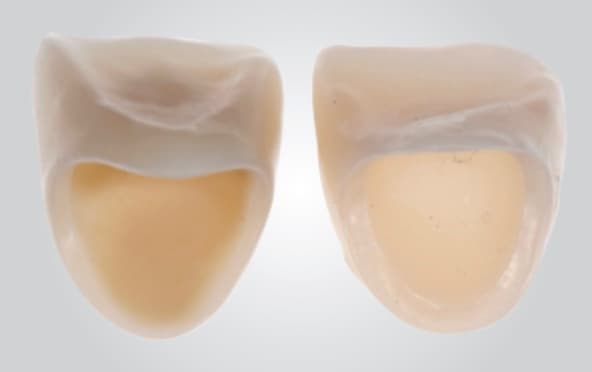 Internal surface of zirconia coping with opaque liquid applied pre-sinter and post-sinter (Images 1 & 2), and true opacity gained (Image 3)