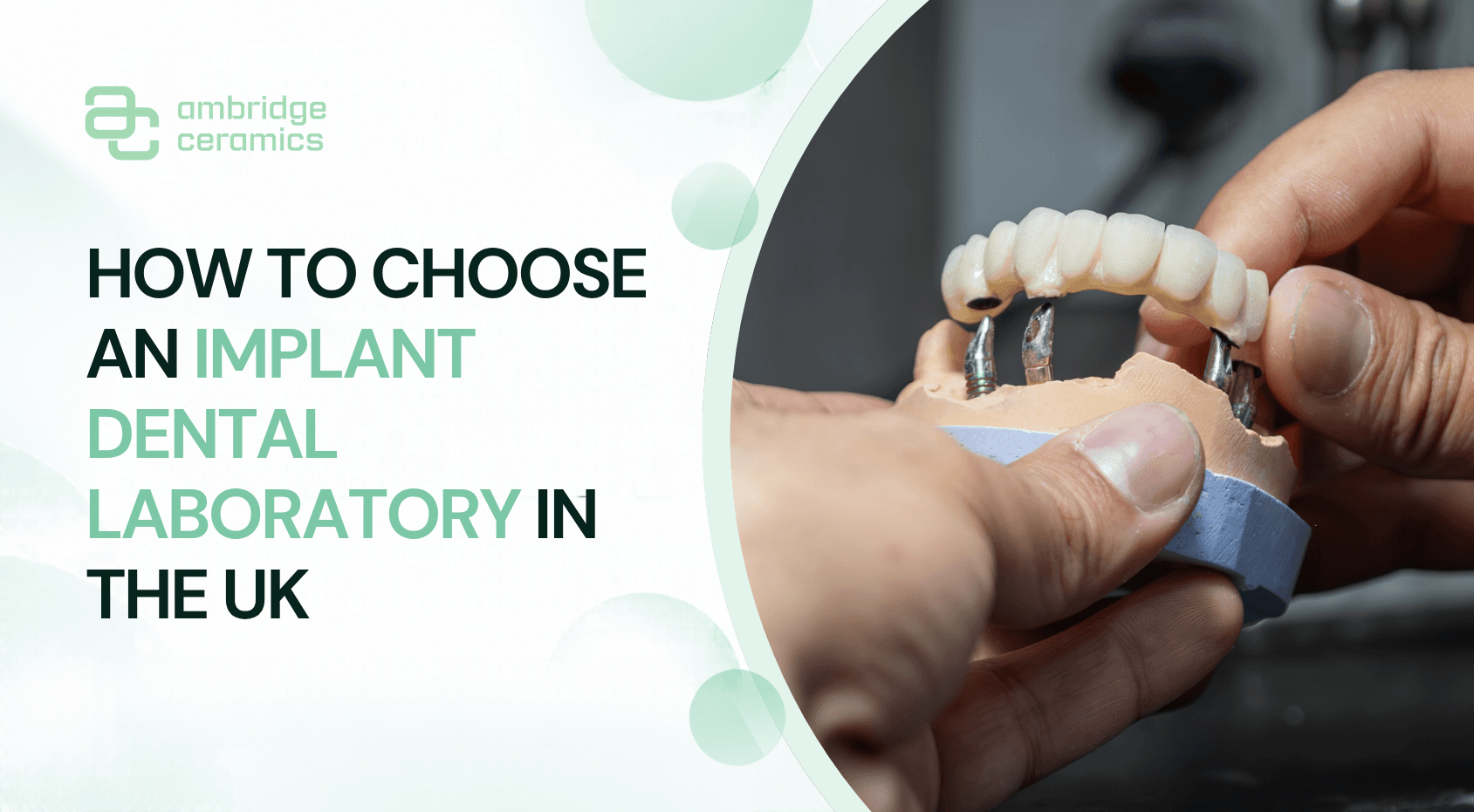 How to Choose an Implant Dental Laboratory in the UK — Ambridge Ceramics