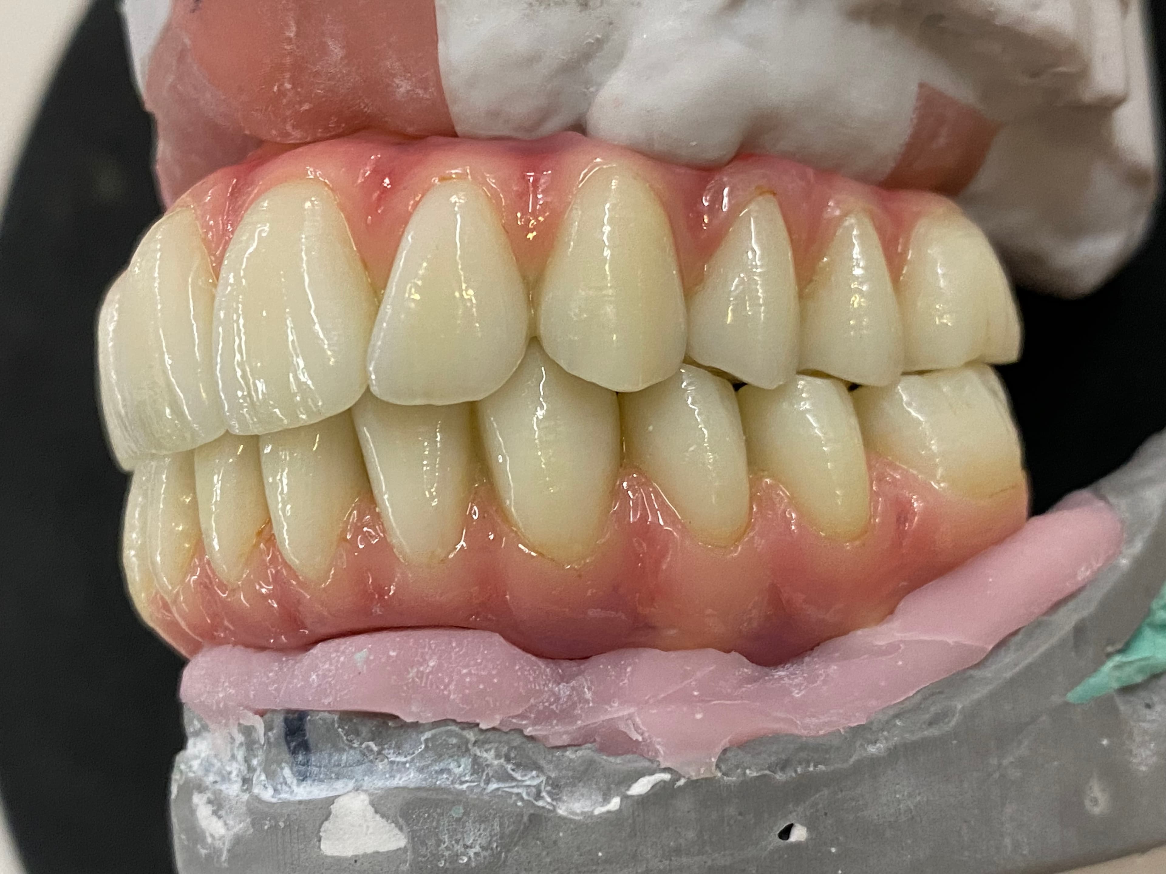 Full Upper & Lower Composite Wraps – image 1