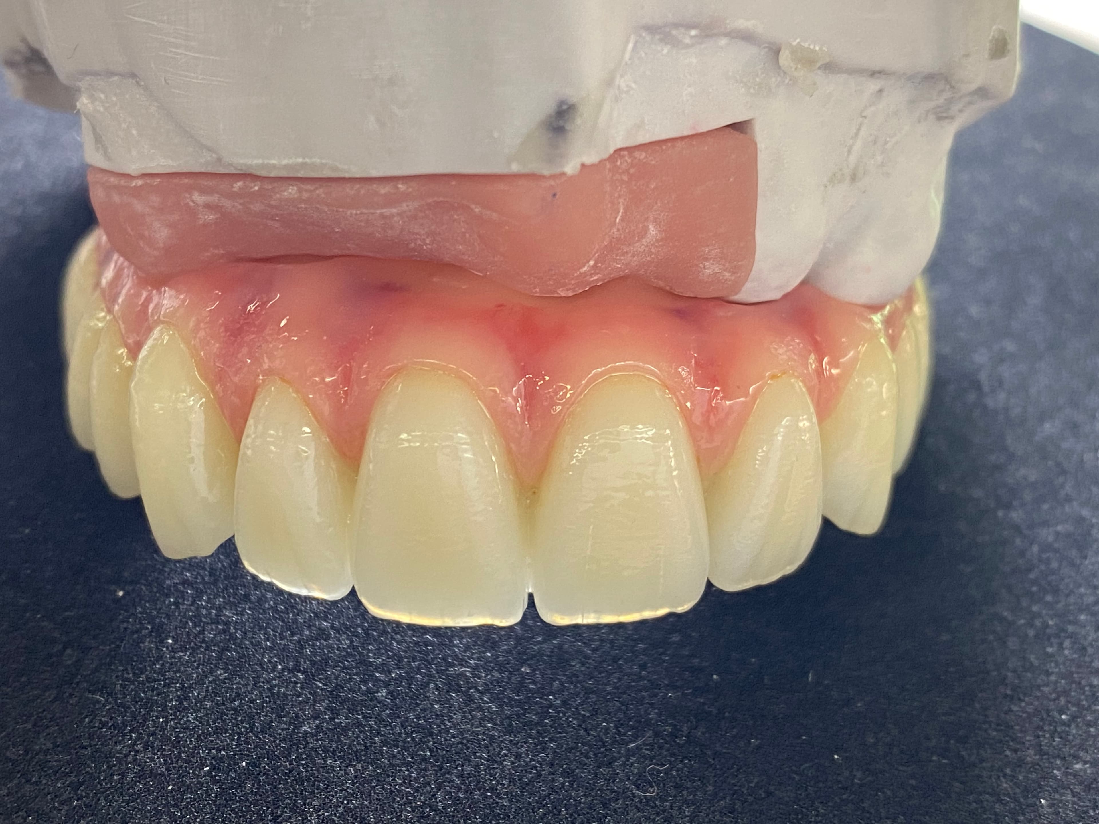 Full Upper & Lower Composite Wraps – image 4