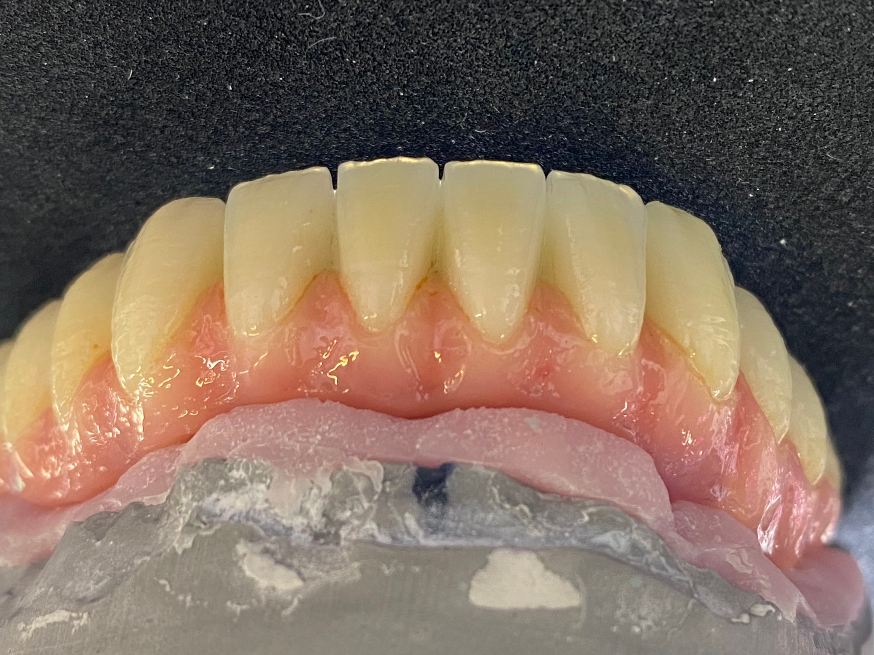 Full Upper & Lower Composite Wraps – image 5