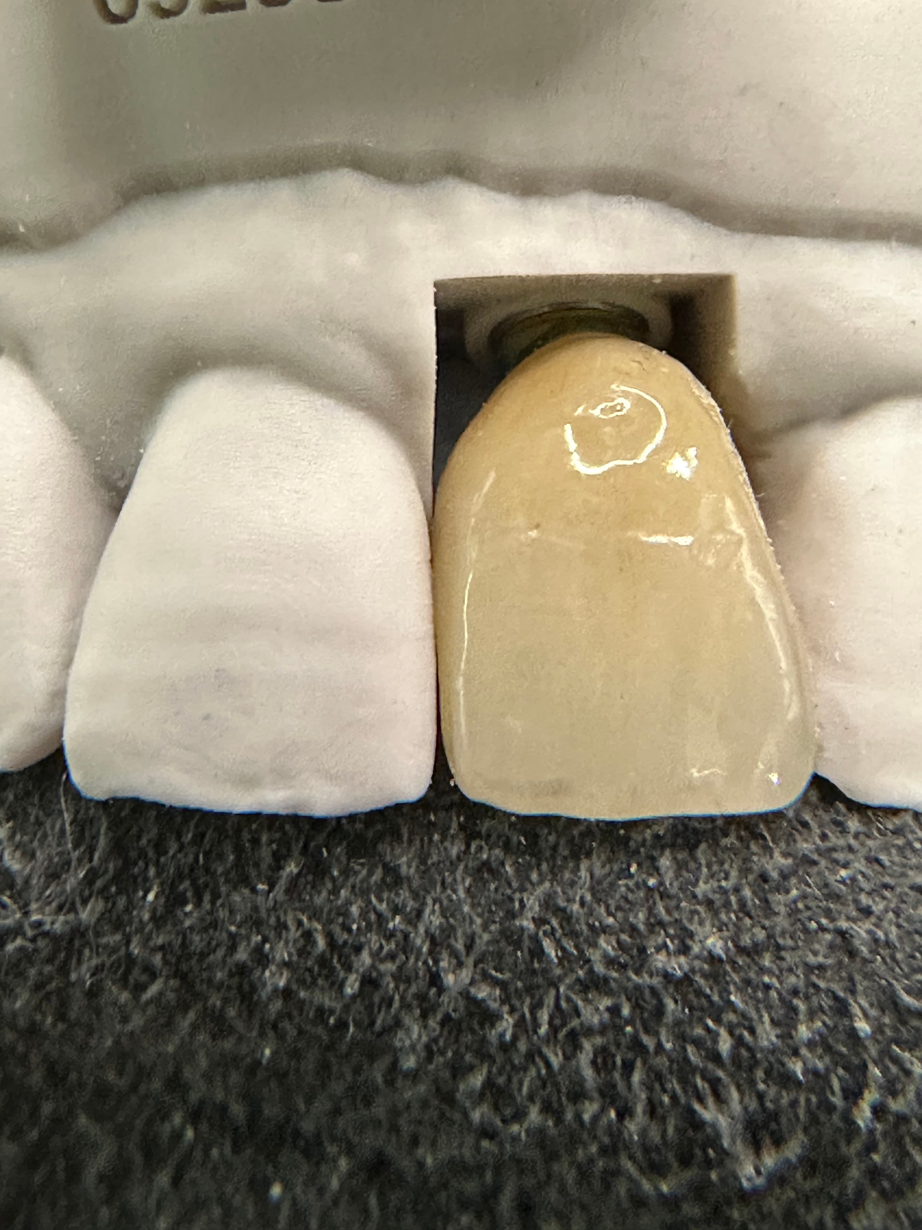 Emergence Critical Central Implant Crowns – image 3