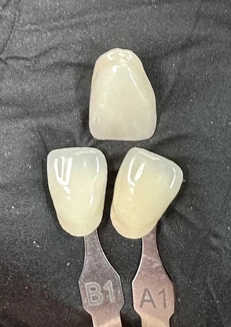 Shade adjustment process for a difficult case