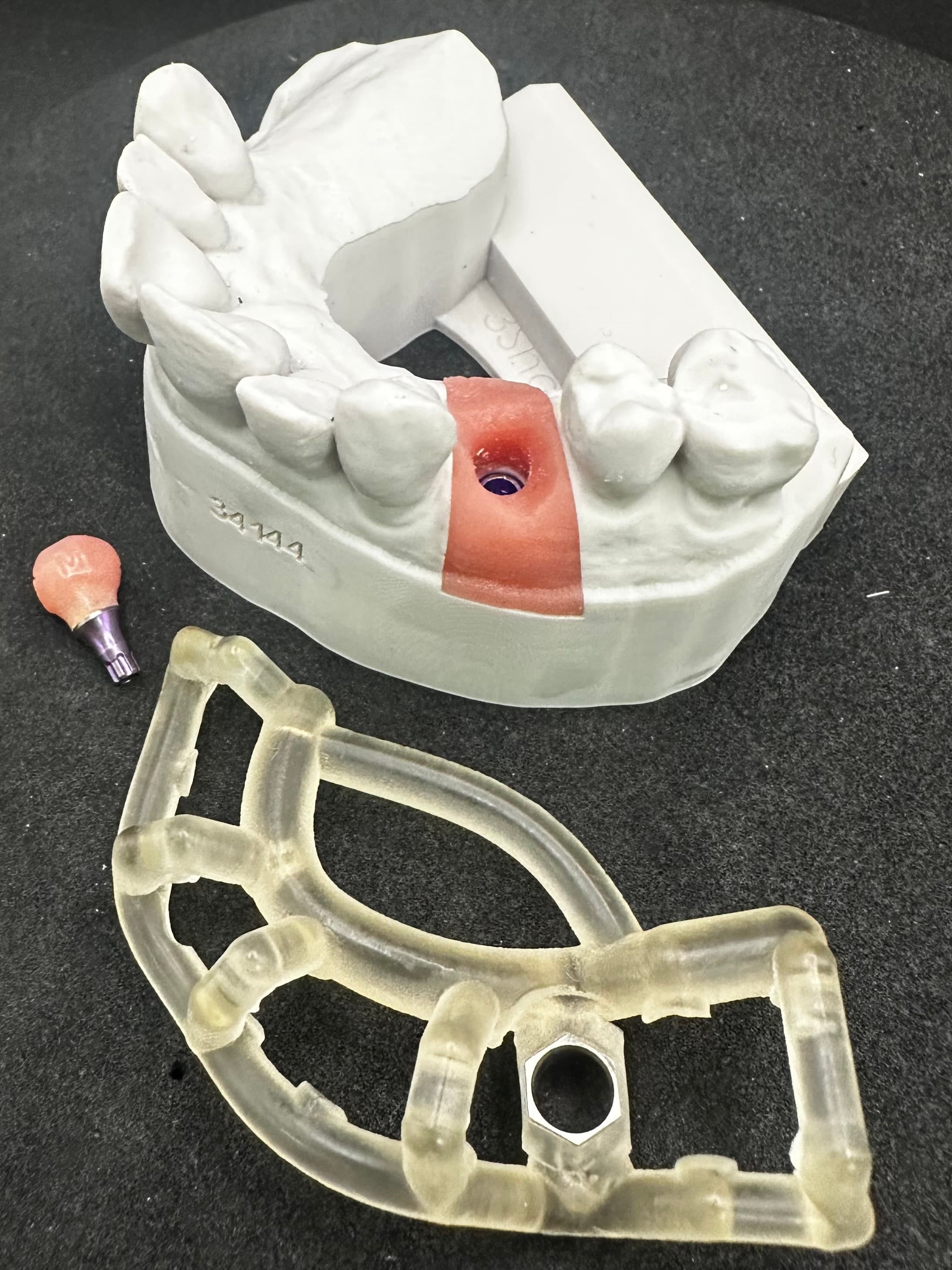 Implant Surgical Guide – image 2