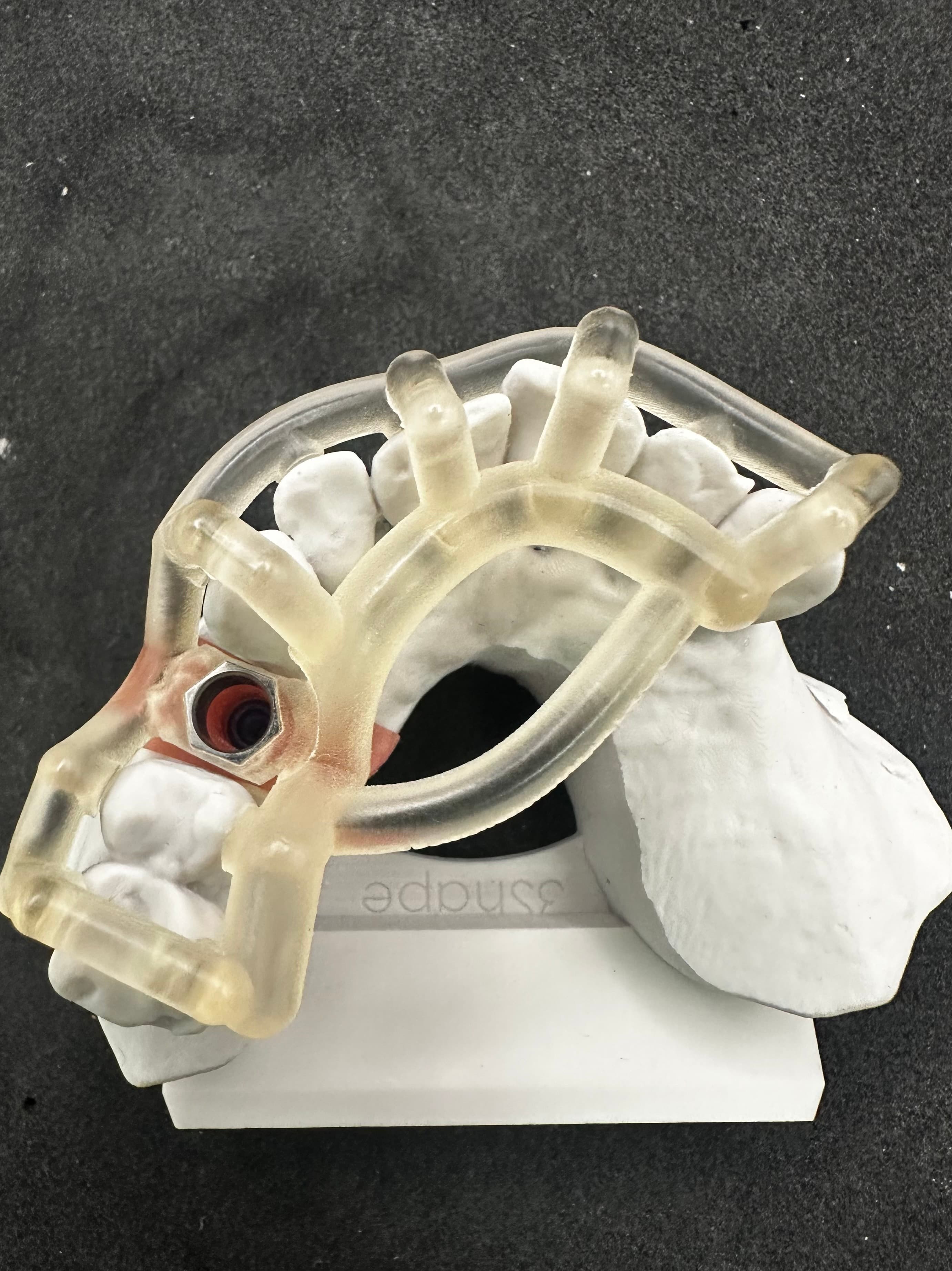 Implant Surgical Guide – image 3