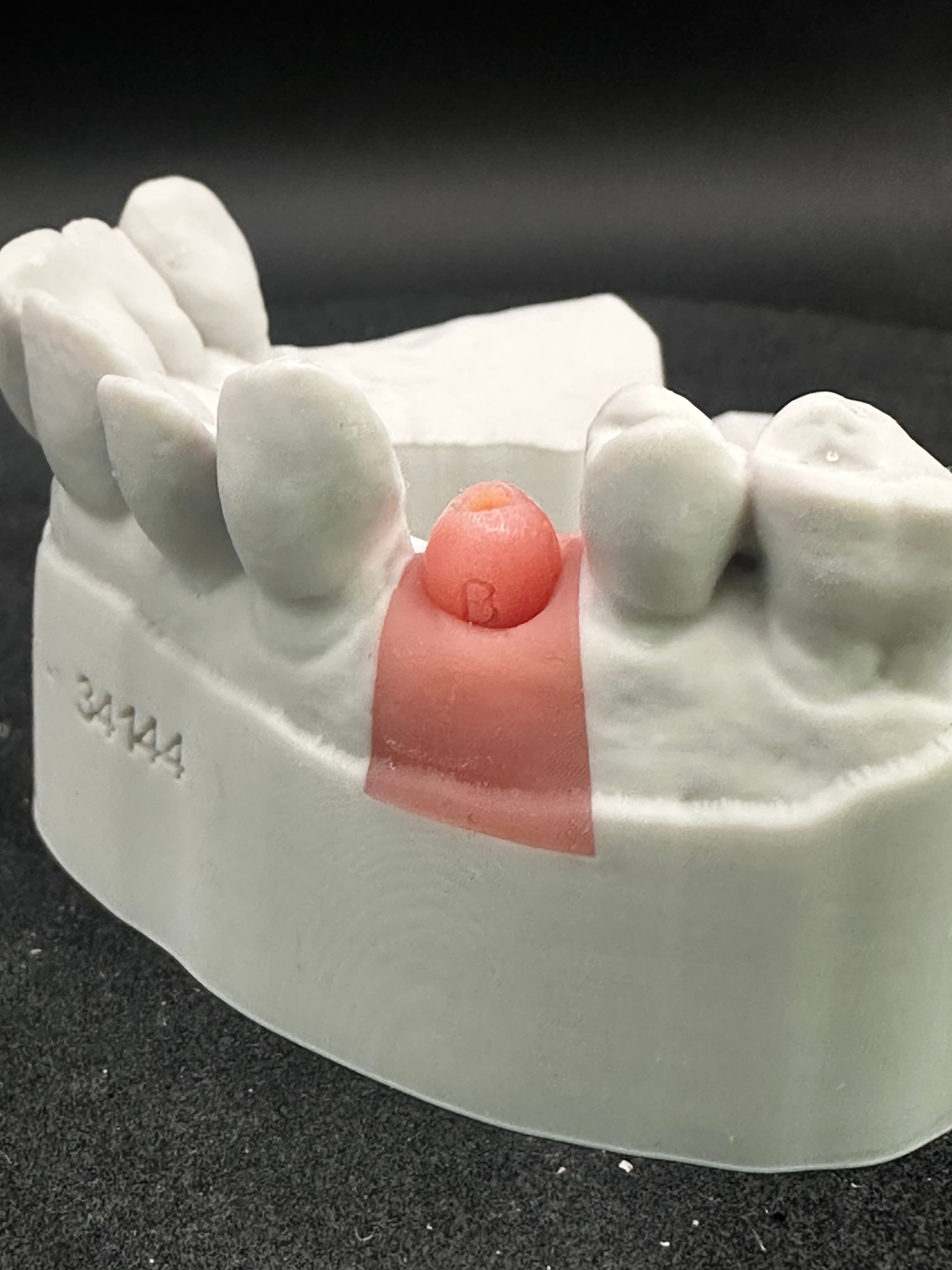 Implant Surgical Guide – image 4