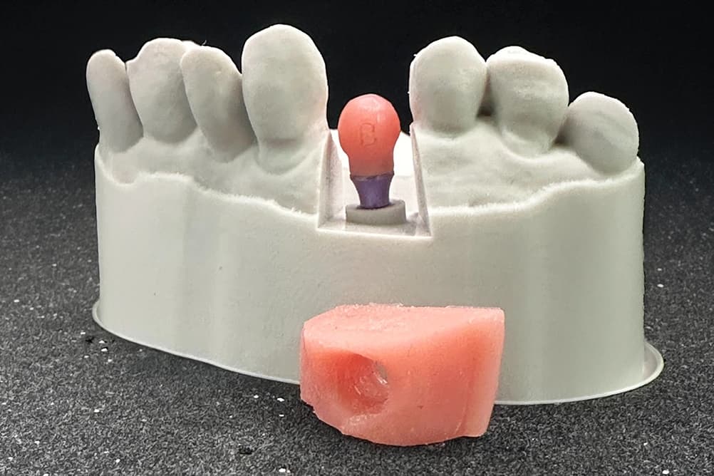 Implant Surgical Guide