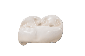 Posterior Crown
