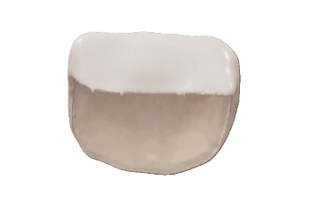 Veneer