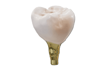Posterior Crown