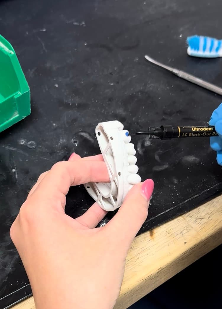 Resin Reservoirs being applied to individual teeth