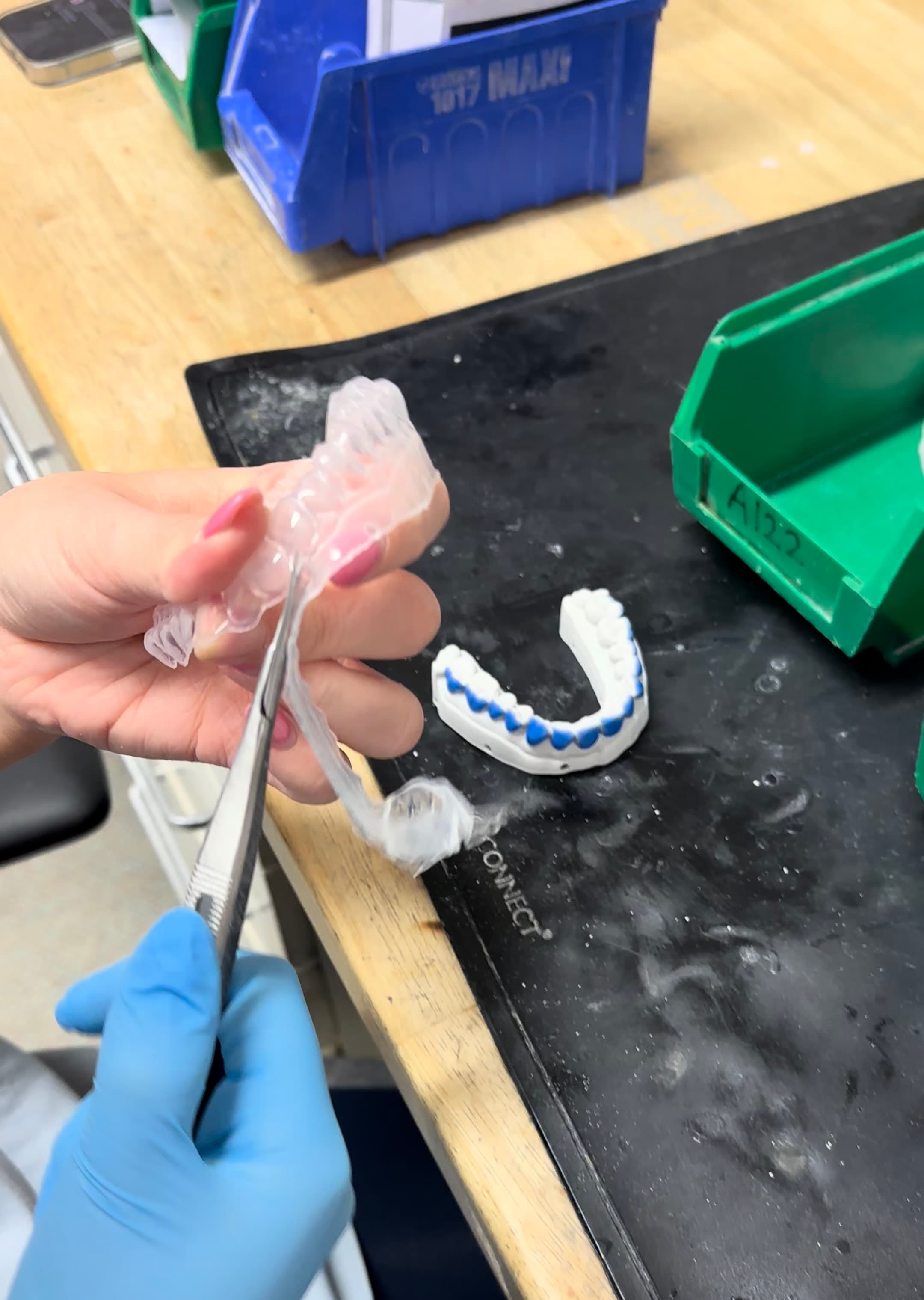 Tray being carefully scalloped/trimmed around gingival margins