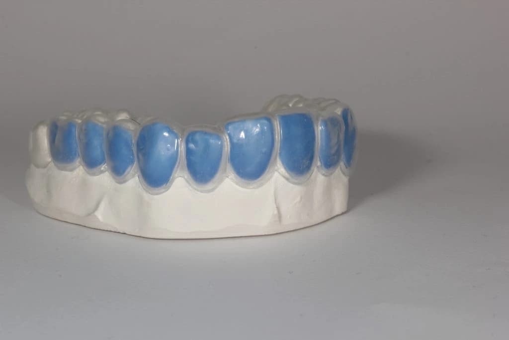 Close‑up showing gingival adaptation 3