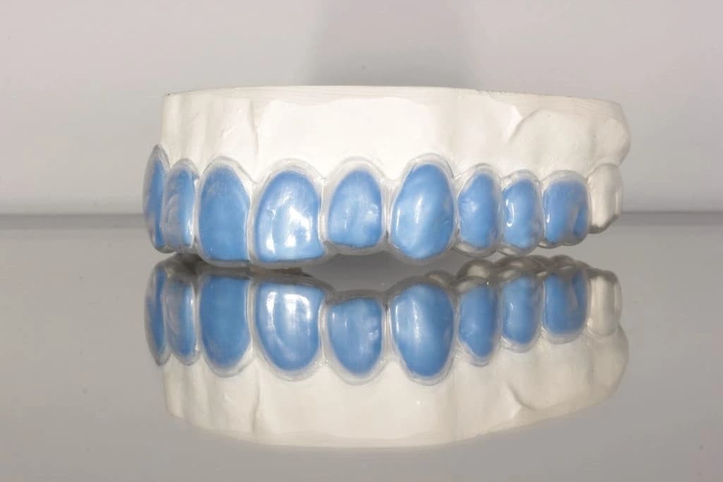 Upper Scalloped Tray with Reservoirs