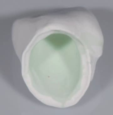 Internal surface of zirconia coping with opaque liquid applied pre-sinter and post-sinter (Images 1 & 2), and true opacity gained (Image 3)