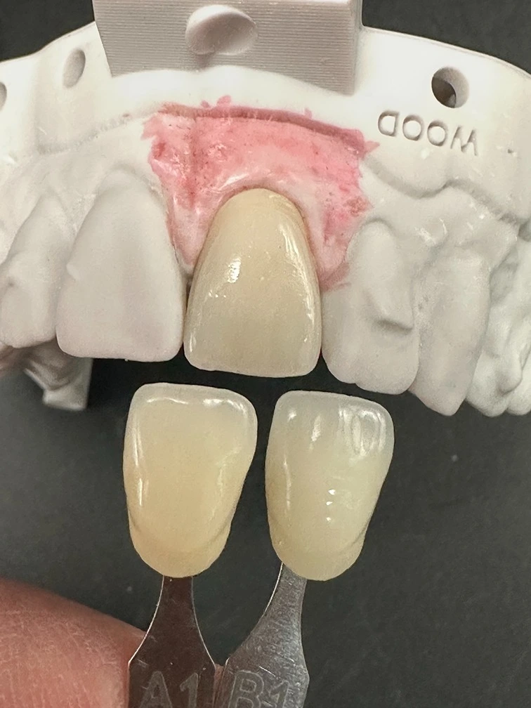 Check the effect of coloured prep inside crown pre-adjustment