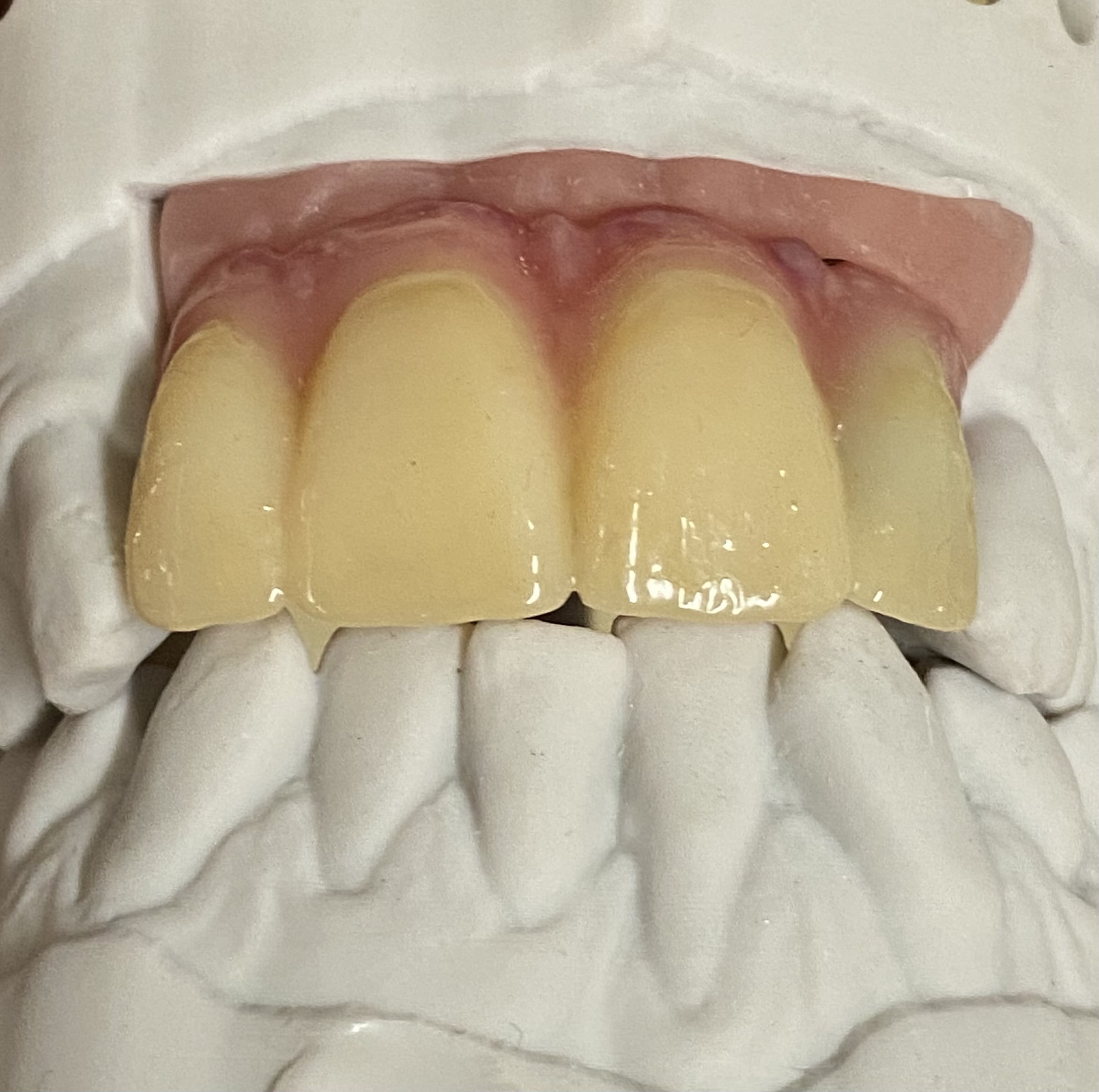 Adaptation to arch and soft tissues