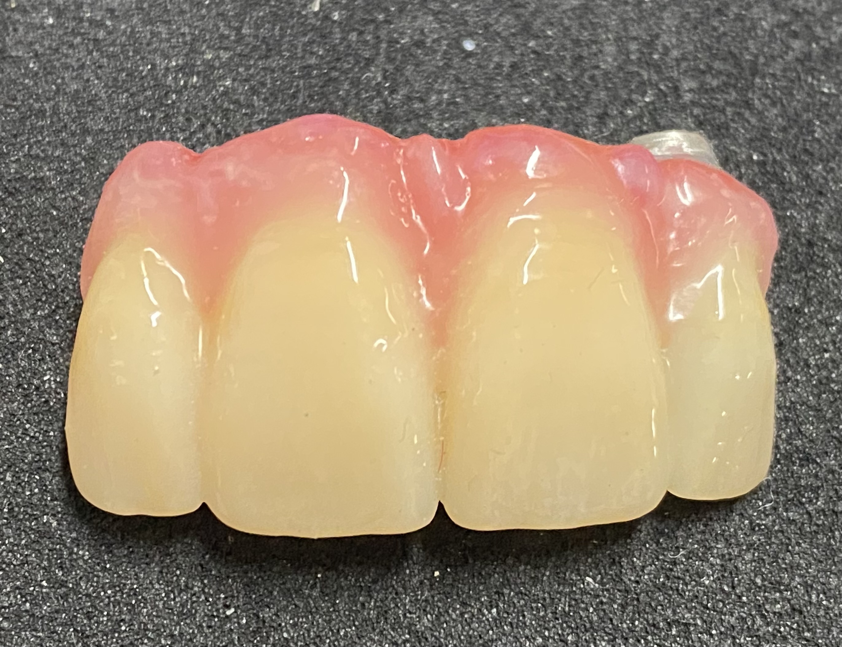 Fully Nano-Glazed surface leaves impervious to staining and plaque.