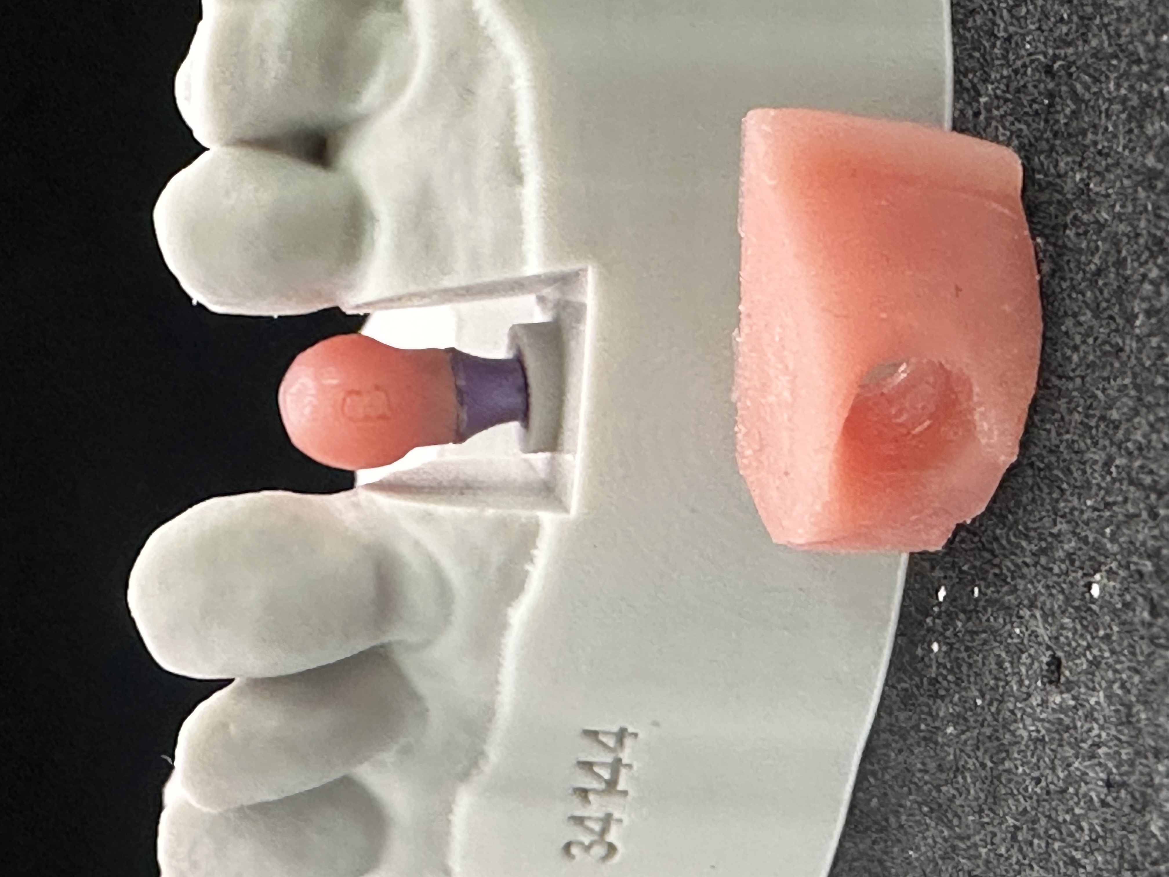 The anatomical shape of the healing abutment, guaranteeing the optimal healing emergence contours of the soft tissues.