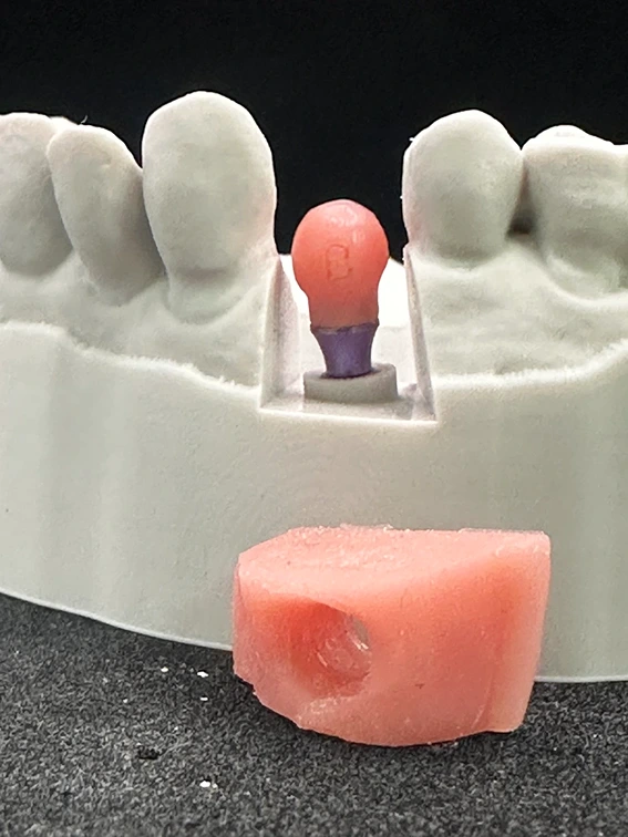 The anatomical shape of the healing abutment, guaranteeing the optimal healing emergence contours of the soft tissues.
